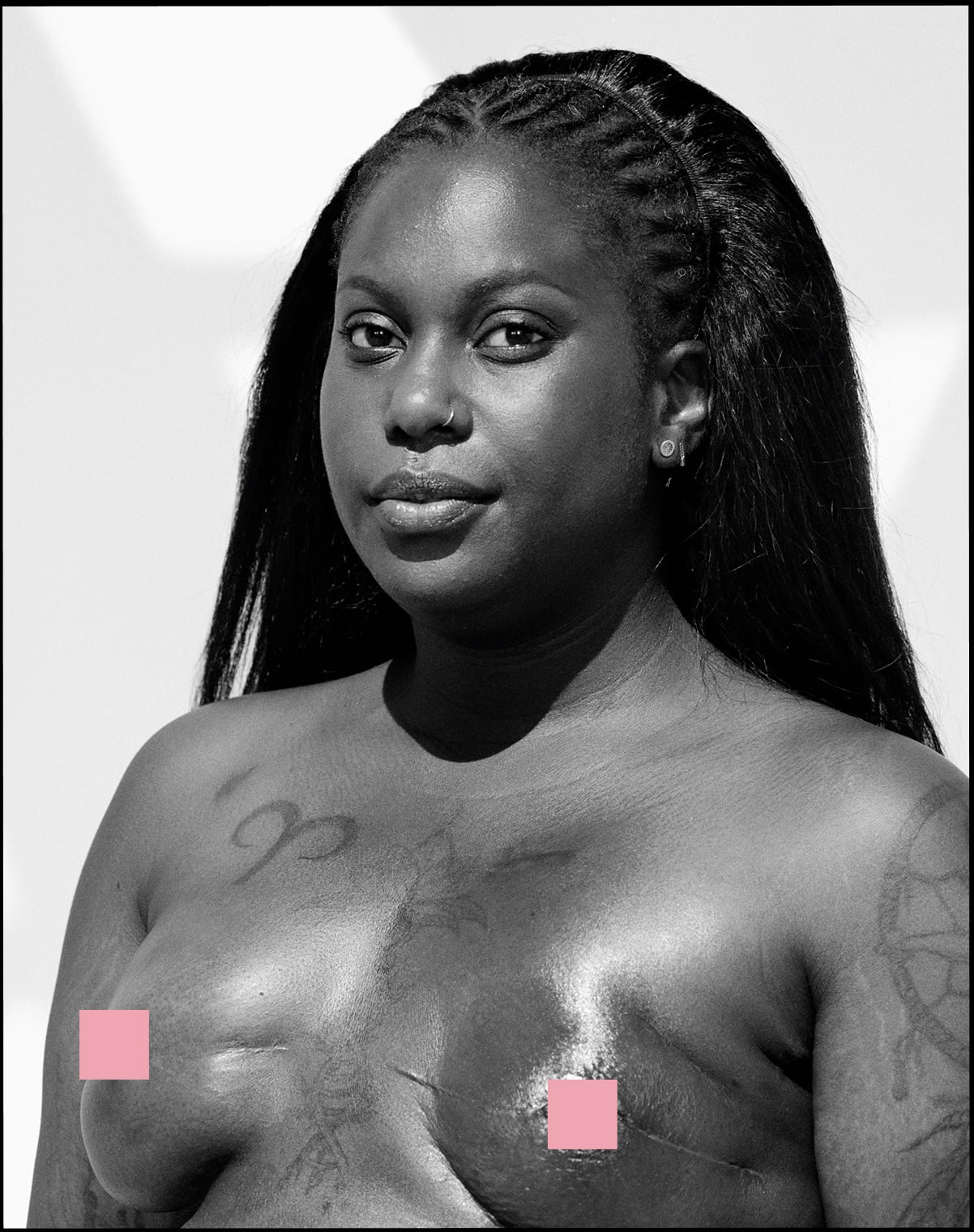 Portrait de Gaelle après sa mastectomie