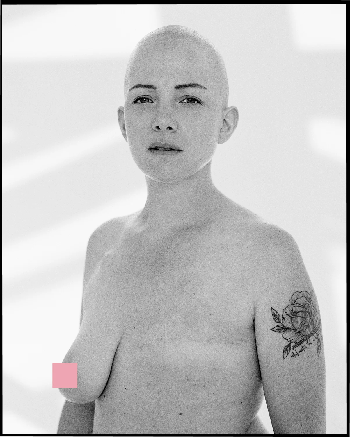 Portrait de MÉLANIE après sa mastectomie