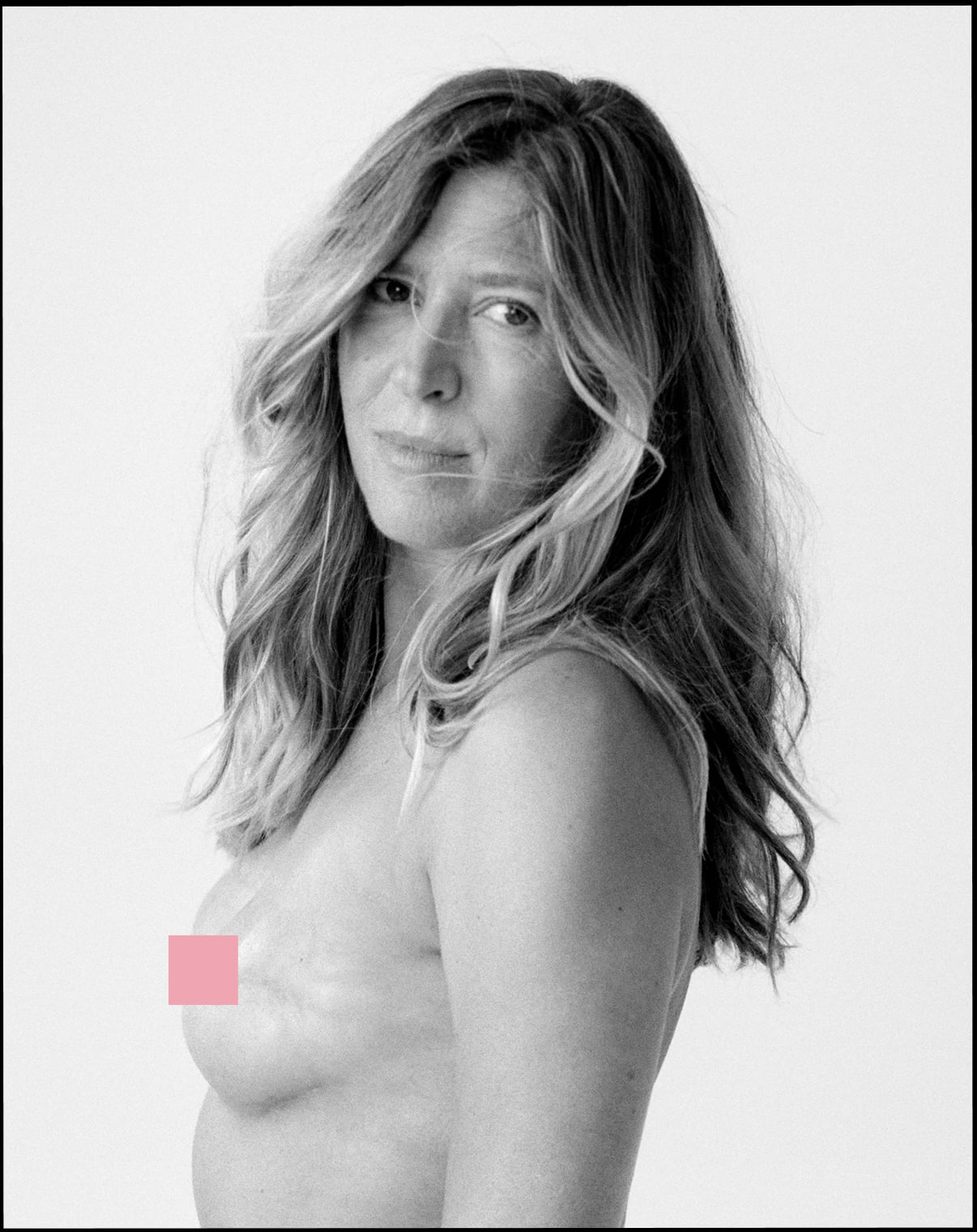 Portrait de MARGHERITA après sa mastectomie